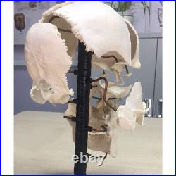 16pcs Human Skull Separation Anatomical Medical Bone Model Supplies Kit Parts