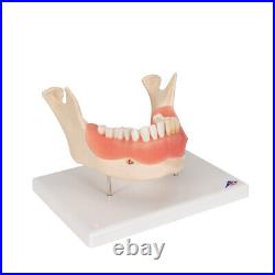 3B Scientific D26 Dental Disease Model Teeth in Jaw Magnified 2 times, 21 parts