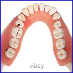 3B Scientific D26 Dental Disease Model Teeth in Jaw Magnified 2 times, 21 parts