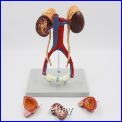 5 Parts Human kidney bladder model Arteriovenous Urinary system model