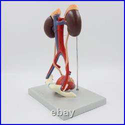 5 Parts Human kidney bladder model Arteriovenous Urinary system model