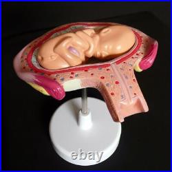 Anatomical Human Fetal Model Baby Fetus Foetus Pregnancy Anatomy Teaching Parts