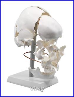Beauchene Exploded Skull Model 13 Parts Life Size Mounted on Articulated S