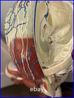 Bobbitt Laboratories Vintage Anatomical Torso Model- Missing Parts
