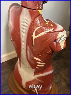 Bobbitt Laboratories Vintage Anatomical Torso Model- Missing Parts