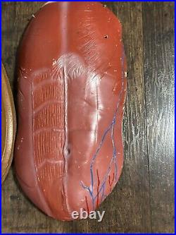 Bobbitt Laboratories Vintage Anatomical Torso Model- Missing Parts