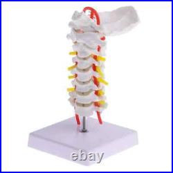 Cervical Spine Carotid Artery Disc Nerves Lumbar Bone Frame Anatomy Model Parts