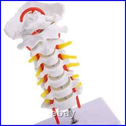 Cervical Spine Carotid Artery Disc Nerves Lumbar Bone Frame Anatomy Model Parts