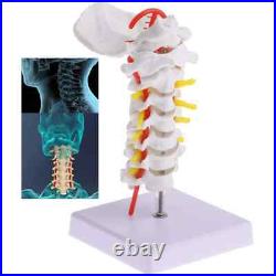 Cervical Spine Carotid Artery Disc Nerves Lumbar Bone Frame Anatomy Model Parts