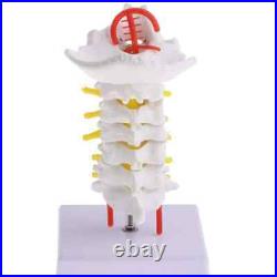 Cervical Spine Carotid Artery Disc Nerves Lumbar Bone Frame Anatomy Model Parts