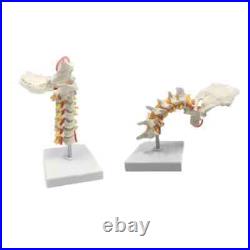 Cervical Spine Carotid Artery Disc Nerves Lumbar Bone Frame Anatomy Model Parts