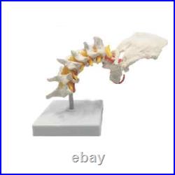Cervical Spine Carotid Artery Disc Nerves Lumbar Bone Frame Anatomy Model Parts