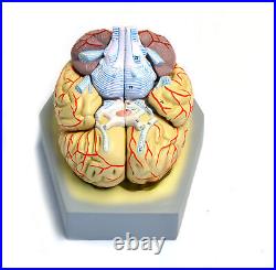 Eisco Labs Model, Human Brain, With Arteries, 9 Parts