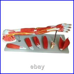 Medical Anatomical Muscular Arm Model, 7 Parts, Life Size, High Quality, New