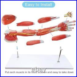 Portable 7-Part Muscular Arm Anatomical Model with Stand for Clinical Education