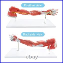 Portable 7-Part Muscular Arm Anatomical Model with Stand for Clinical Education