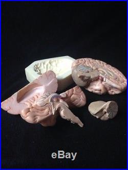 SOMSO Brain Model Natural cast BS22 4 Parts Anatomical Model BS 22
