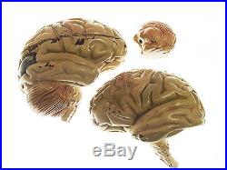 Vintage Model Of Brain & Head Removable Parts Denoyer-Geppert Co Chicago MACABRE
